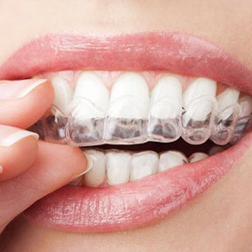 Tips For Maintaining Healthy Teeth And Gums
